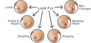 what to look for on your breasts- breast exam